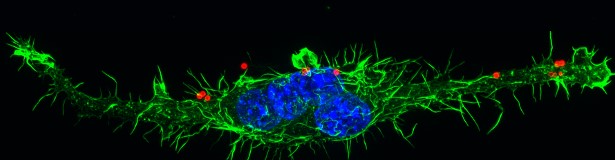 A Quantum Quest to See Inside Bone