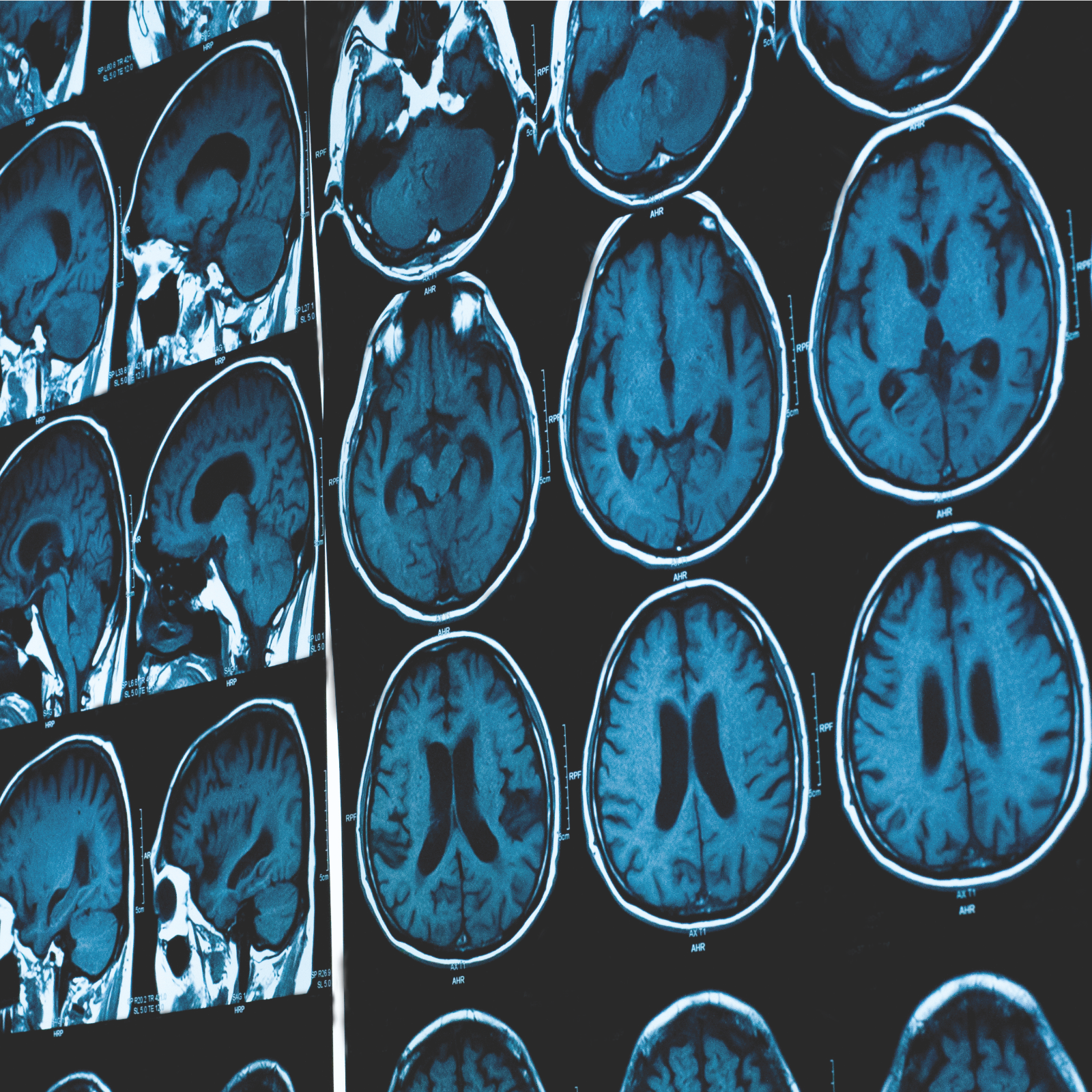 Global quantum leaders unite in Australia to drive a quantum transformation of the life sciences 